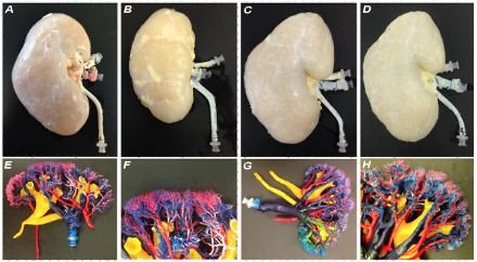 Regeneration tissue engineering